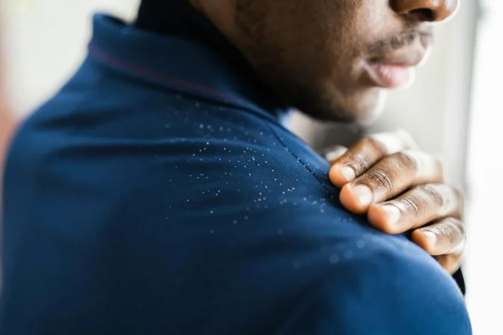 A person brushing flakes from the shoulder of a dark shirt.