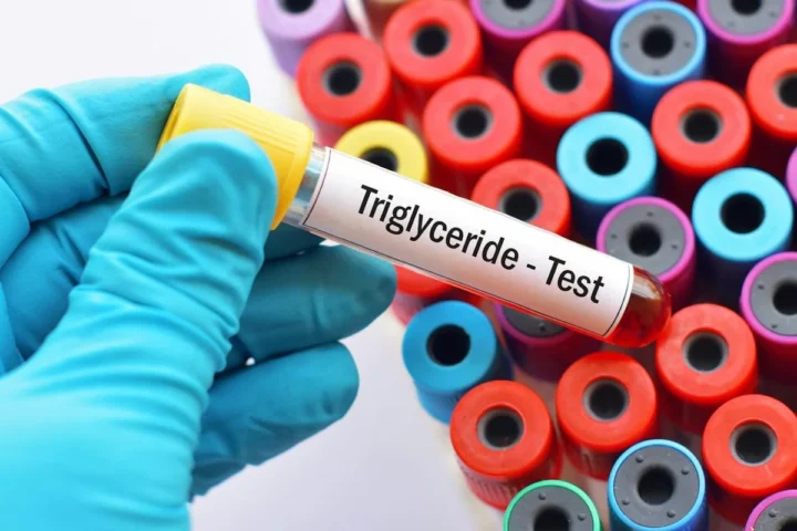 A gloved hand holding a blood sample tube labeled for a triglyceride test.