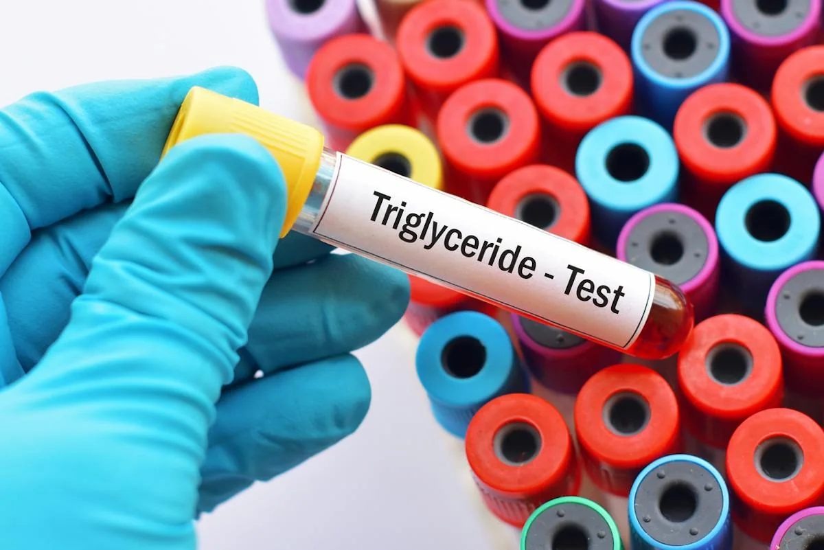 A gloved hand holding a blood sample tube labeled for a triglyceride test.